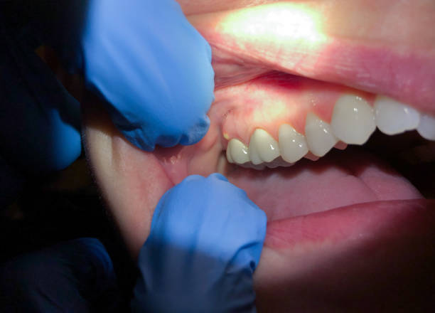 Best Cracked Tooth Emergency Dentist  in Hettinger, ND