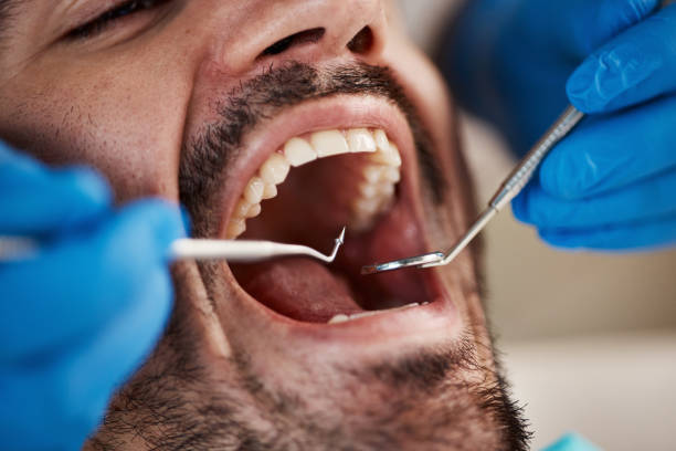 Best Emergency Tooth Extraction  in Hettinger, ND